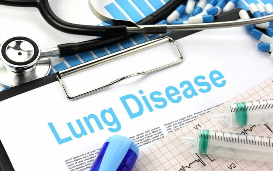 How is Lung Cancer Treated?